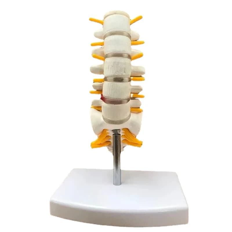 Modèle d'Anatomie Humaine à 5 Segments pour la Colonne Lombaire et Vertébrale, Accessoire pour nerf